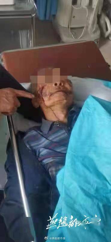 中国当局表示，北方城市辽宁一家餐馆发生火灾，造成22人死亡，3人受伤